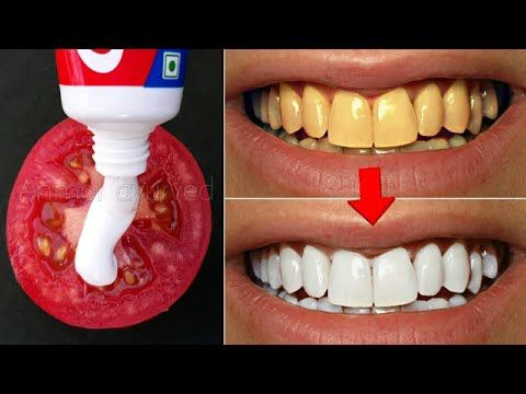 cách làm trắng răng bằng cà chua và kem đánh răng