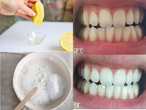 cách làm trắng răng bằng muối hạt