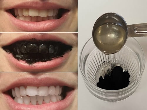 cách làm trắng răng tại nhà bằng than hoạt tính