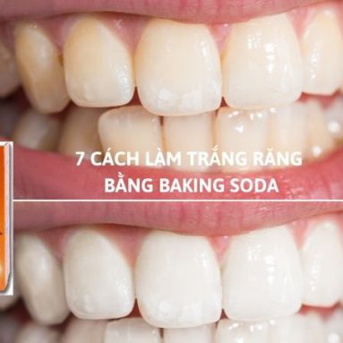 [Hướng dẫn] 7 Cách làm trắng răng bằng Baking Soda đơn giản