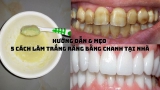 5 Cách làm trắng răng bằng Chanh hiệu quả tại nhà