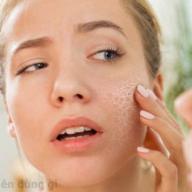 Da mặt khô nên dùng gì? 14 cách làm mặt hết khô tại nhà
