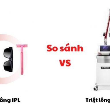 [So sánh] công nghệ Triệt lông IPL và Laser